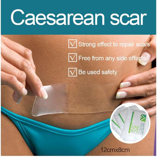 Survival Silicone Gel Scar Patch Scar Away Surgery Removal Scar Sheet Therapy Patch Acne Burn Scar Skin Repair Medical Tape